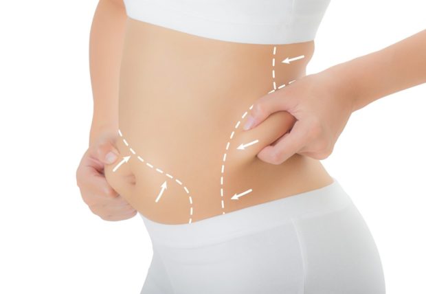 Fat Layers Reduction with Coolsculpting- SA Flawless