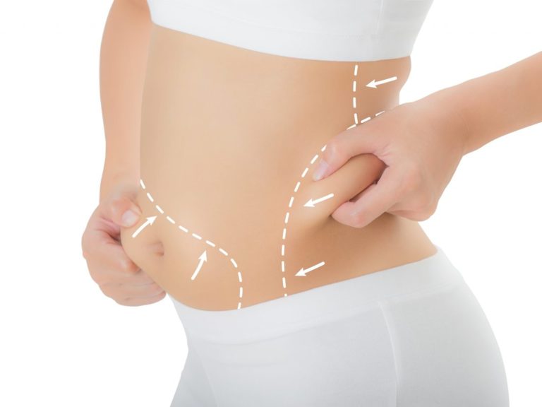 Fat Layers Reduction with Coolsculpting- SA Flawless