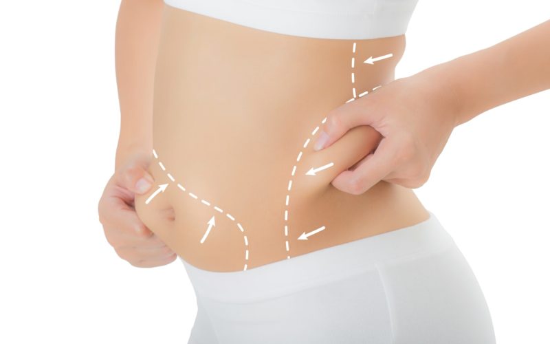 Slim Sculpt & Fat Reduction Services