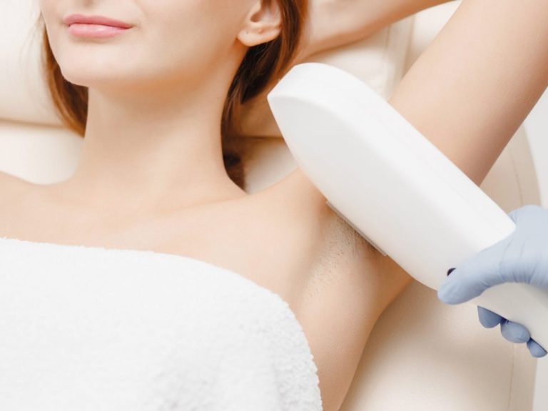 Laser Hair Removal Procedure by Flawless Laser