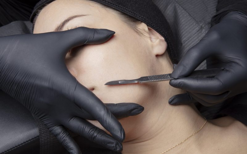 Dermaplaning Dermaplaning San Antonio, TX