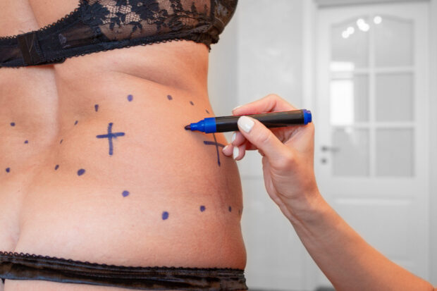 15 Terms Everyone in the Skin Pen Treatment Industry Should Know