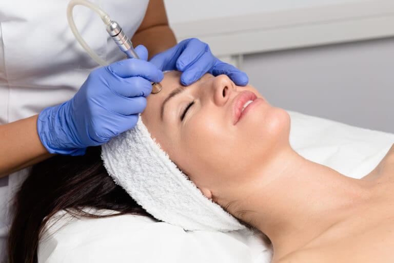 Microdermabrasion: How It Works to Improve Your Skin