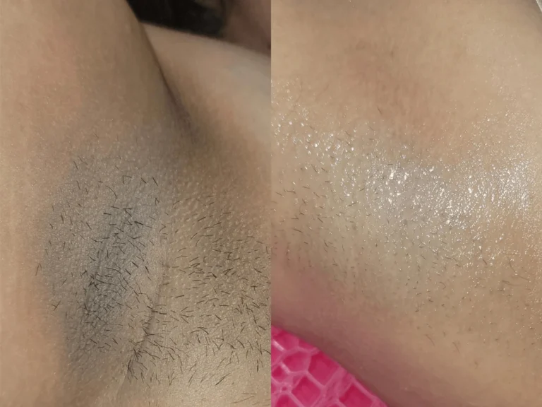 Intimate lighting before and after sa flawless g