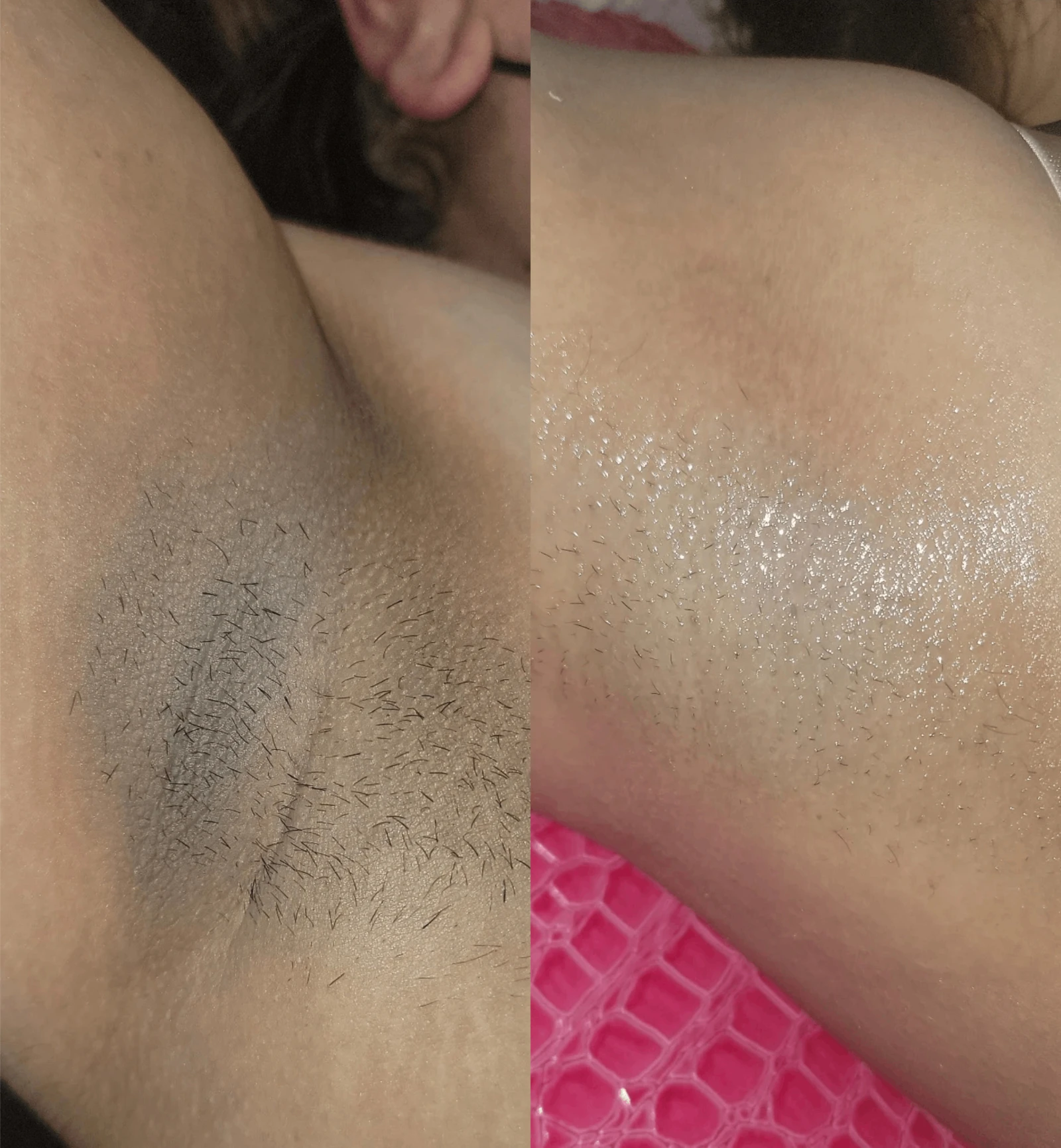 Intimate lighting before and after sa flawless g Intimate lighting before and after sa flawless g
