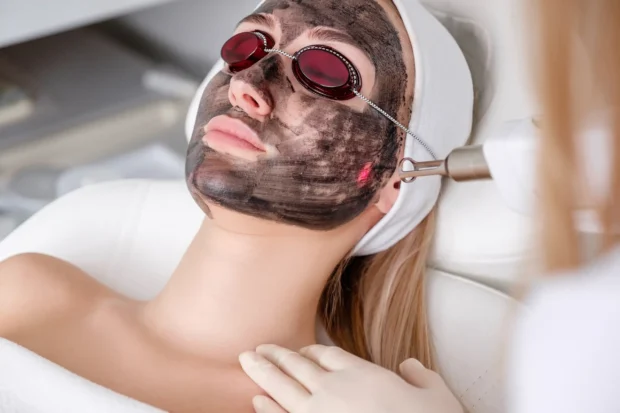 Patient receiving carbon laser facial treatment to improve skin tone, reduce acne, and rejuvenate complexion at a professional medical spa.