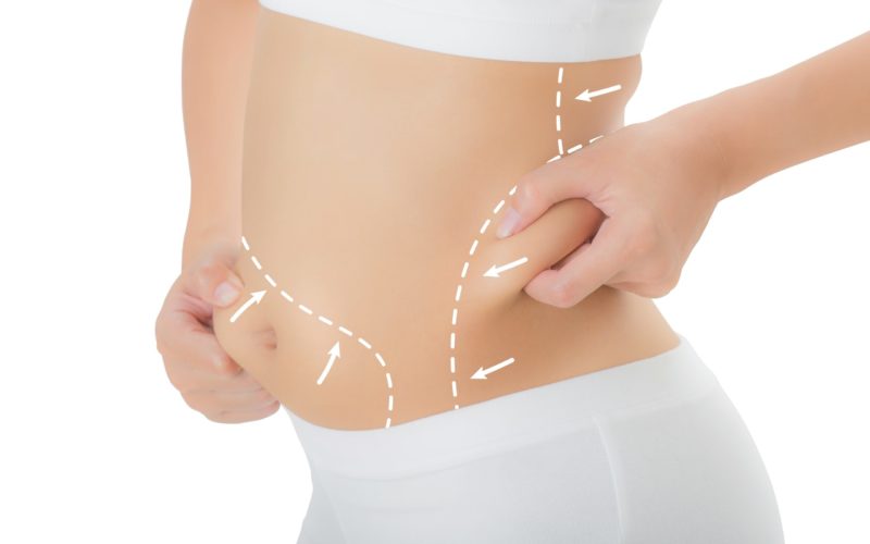 Fat Layers Reduction with Coolsculpting- SA Flawless
