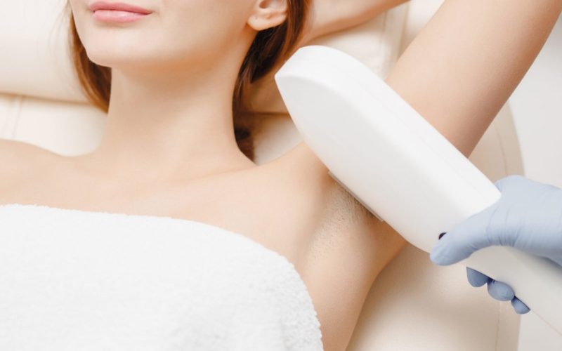 Laser Hair Removal Procedure by Flawless Laser