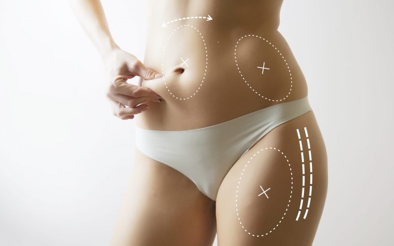 What Is Evolve Trim? How Will It Work To Your Benefit? SA Flawless What Is Evolve Trim? How Will It Work To Your Benefit? SA Flawless