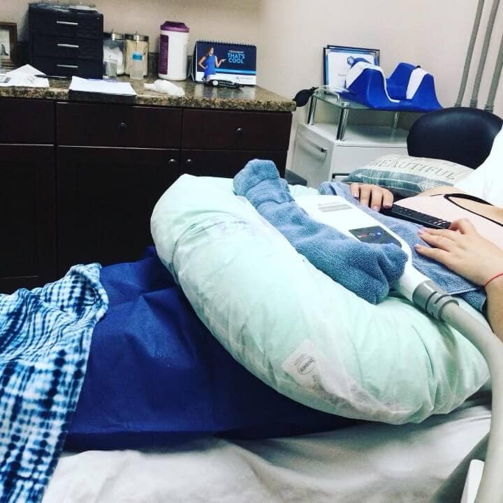 CoolSculpting